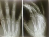 Фотография Натарова Алексея